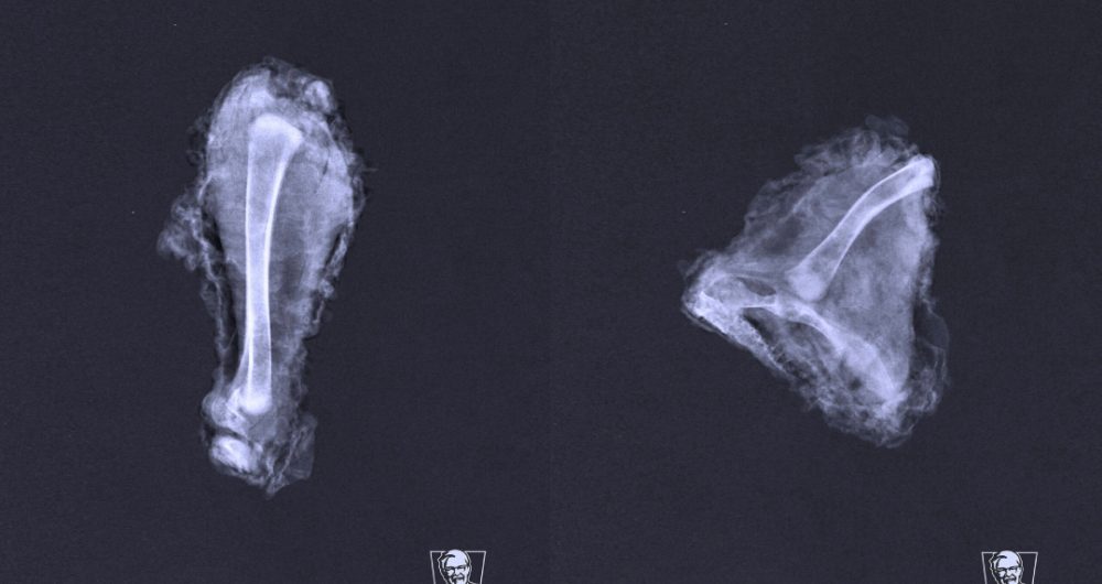 KFC-Spain-X-Ray-PS21-1.jpg.def2dbba5d0b7e0ebf277852ecfe9ea6