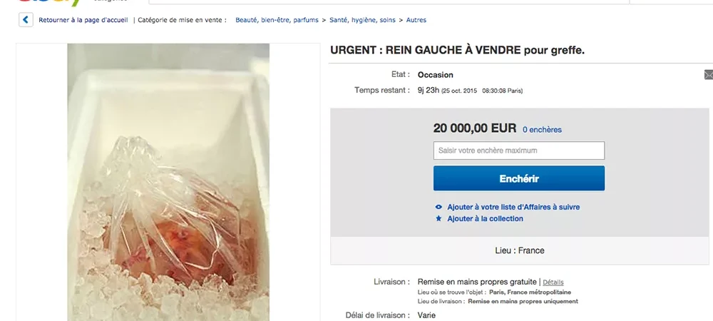 dans-ta-pub-ebay-organe-rein-femme-don-d'organe-3