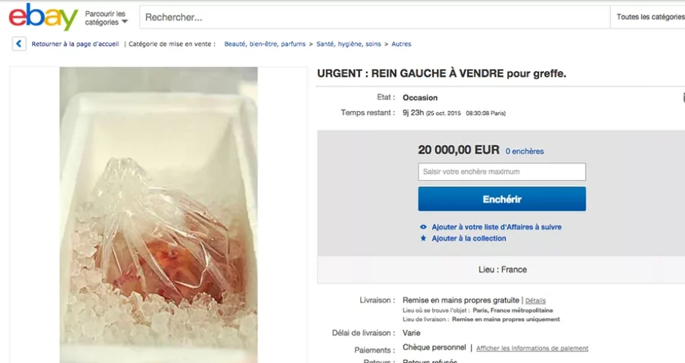 dans-ta-pub-ebay-organe-rein-femme-don-d'organe-3